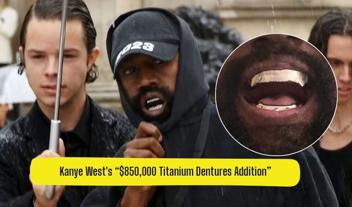Kanye West's “$850,000 Titanium Dentures Transformation”